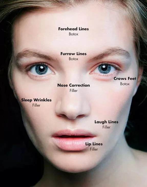 The Art of Lip Filler For Thin Lips: Achieve a Natural Look Lip Filler For Thin Lips